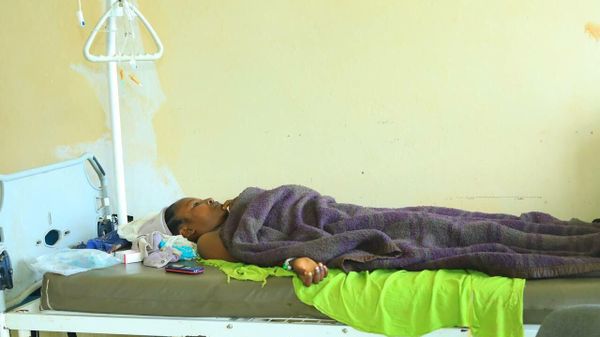በደቡብ ምዕራብ ኢትዮጵያ ለፅንስ ክትትል ሆስፒታል የሄደችው ወጣት 7 ኪሎ ግራም እጢ ተገኘባት - Sputnik አፍሪካ